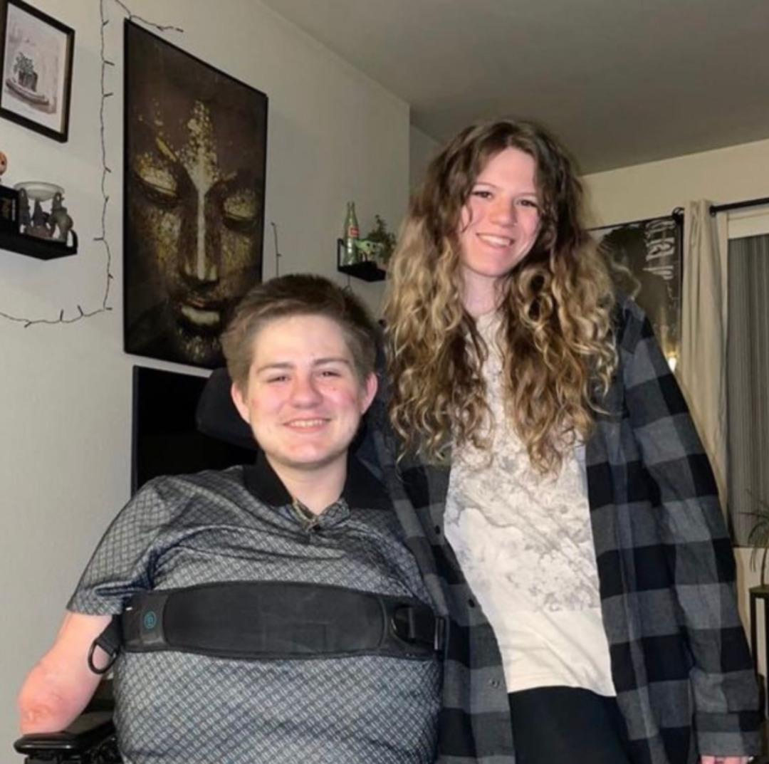 Korkunç kaza hayatını değiştirdi: Vücudunun yarısı yok! "Ölmeyeceğimi anlayınca ortadan kayboldular” 2