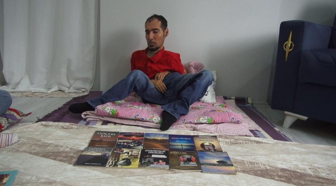 Ne ellerini ne de ayaklarını kullanabiliyor: 20 yılda 16 kitap çıkardı! 3