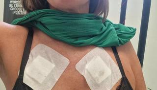 İnternetten aldığı 2 euro'luk s&uuml;tyen kadının g&ouml;ğs&uuml;n&uuml; yaktı