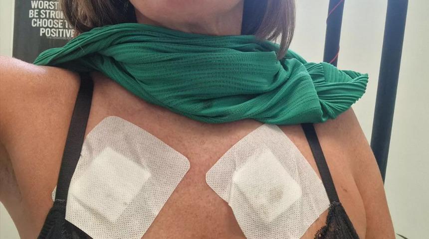 Satışları durdurdular! İnternetten aldığı s&uuml;tyen g&ouml;ğs&uuml;n&uuml; yaktı