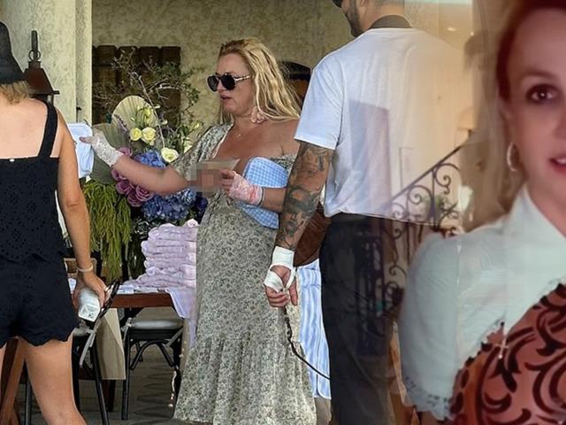 G&ouml;renleri endişelendirdi! "G&ouml;ğ&uuml;sleri s&uuml;rekli a&ccedil;ıktı"