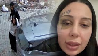 Başına silah dayayıp darbetmişti! Korkun&ccedil; detaylar: "Tecav&uuml;z etti, evlendik şiddet başladı"