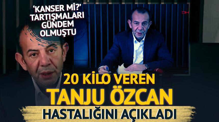 20 kilo vermişti! Tanju &Ouml;zcan hastalığını a&ccedil;ıkladı