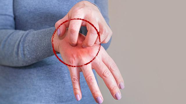 Son 30 yılda vakalar arttı: 2 haftada kendini gösteriyor! 3 yıl süren var