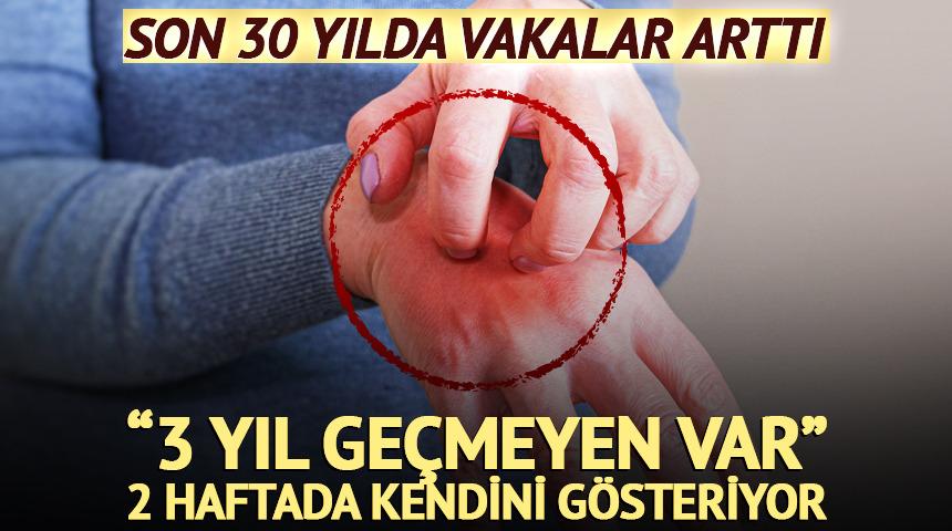 Son 30 yılda vakalar arttı: "3 yıl s&uuml;ren var"