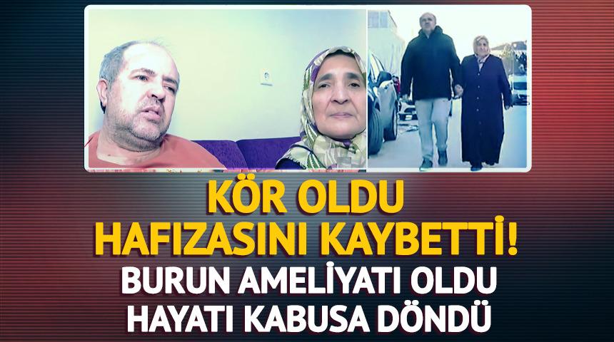 Burun ameliyatı oldu hayatı kabusa d&ouml;nd&uuml;!