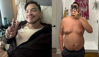 32 yaşındaki adam g&ouml;ğ&uuml;s estetiği s&uuml;recini anlattı 