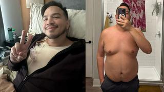 32 yaşında göğüs estetiği oldu: 280 bin TL ödedi! Operasyon erkekler arasında yaygınlaşıyor