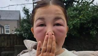 O &uuml;r&uuml;n&uuml; kullandı, sabah uyandığında dehşete d&uuml;şt&uuml;! 