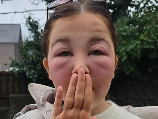 O &uuml;r&uuml;n&uuml; kullandı, sabah uyandığında dehşete d&uuml;şt&uuml;! 