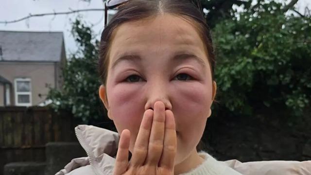 O ürünü kullandı, sabah uyandığında dehşete düştü! Annesi sağlık ekiplerini aradı