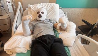 &Ccedil;ay demleyen işitme engelli gen&ccedil; kabus yaşadı: "Patlama oldu, ev &uuml;st&uuml;me yıkıldı"