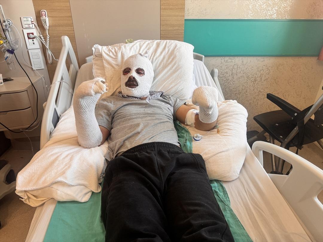 Engelli genç kabusu yaşadı: Çay demlerken patlama oldu, ev üzerine yıkıldı! 2