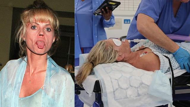 Bağımlılığı hayatını bitirdi: Burnunun kemiği yok oldu! Aynalara küsmüştü