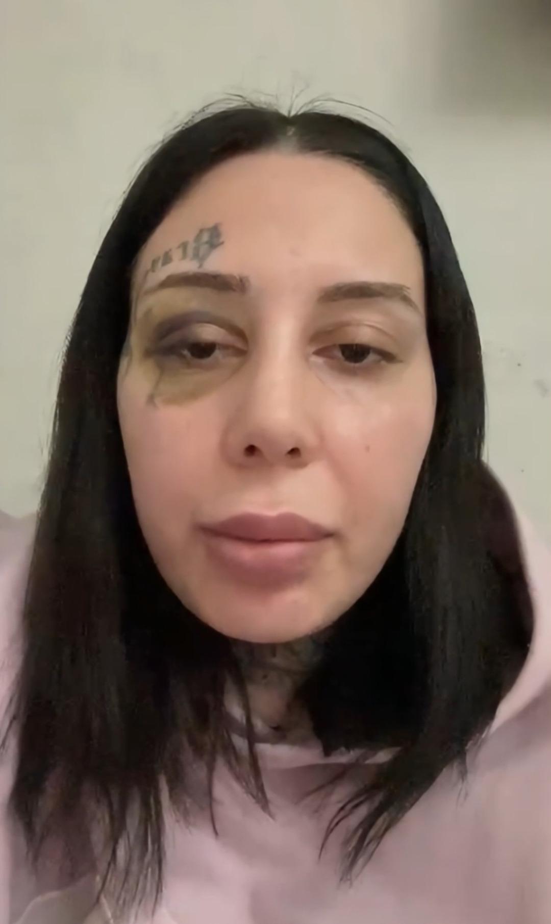 Eşini sokak ortasında darbedip başına silah dayamıştı!  Pes  dedirten savunma: 