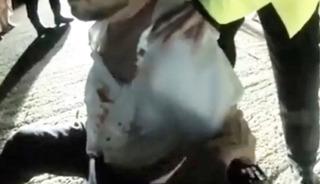 En g&uuml;zel g&uuml;nleri mahvoldu: Arkadaşı amcasını ısırdı