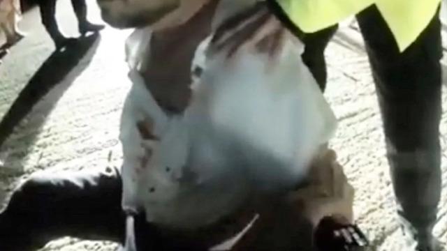 Düğünde dehşet anları: Sarhoş davetli damadın amcasının parmağını ısırarak kopardı