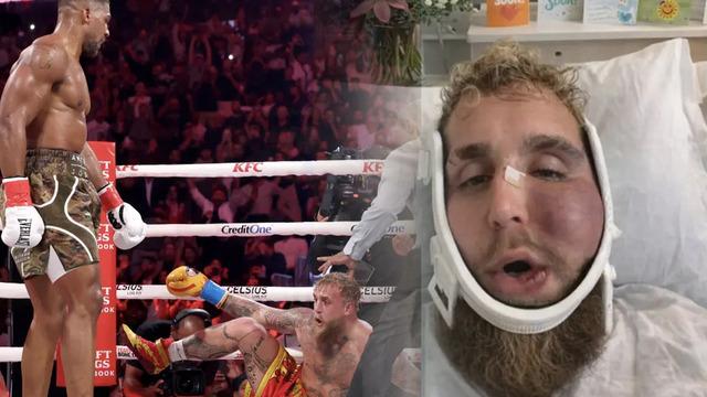 Joshua &ccedil;enesini kırmıştı! Paul'un son hali g&uuml;ndem oldu