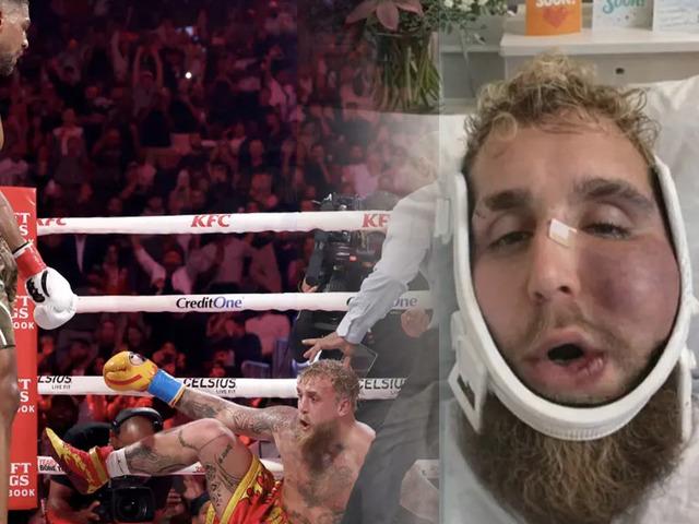 Joshua &ccedil;enesini kırmıştı! Paul'un son hali g&uuml;ndem oldu