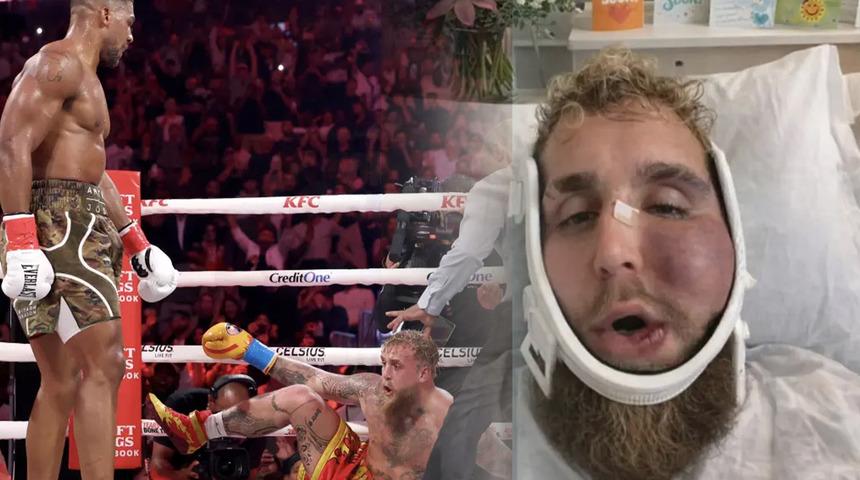 Anthony Joshua &ccedil;enesini kırmıştı! Jake Paul'un son hali g&uuml;ndem oldu