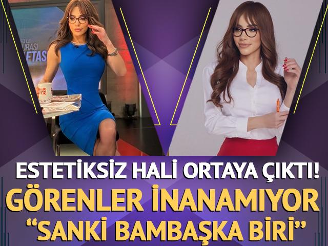 Estetiksiz hali g&uuml;ndem oldu! Kimse tanıyamadı