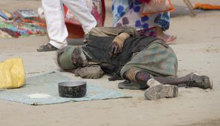 44 yıl aradan sonra ilk kez o hastalık g&ouml;r&uuml;ld&uuml;