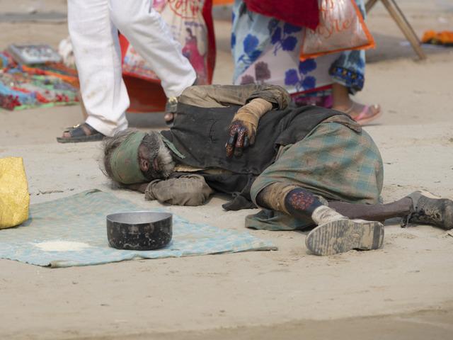 44 yıl aradan sonra ilk kez o hastalık g&ouml;r&uuml;ld&uuml;