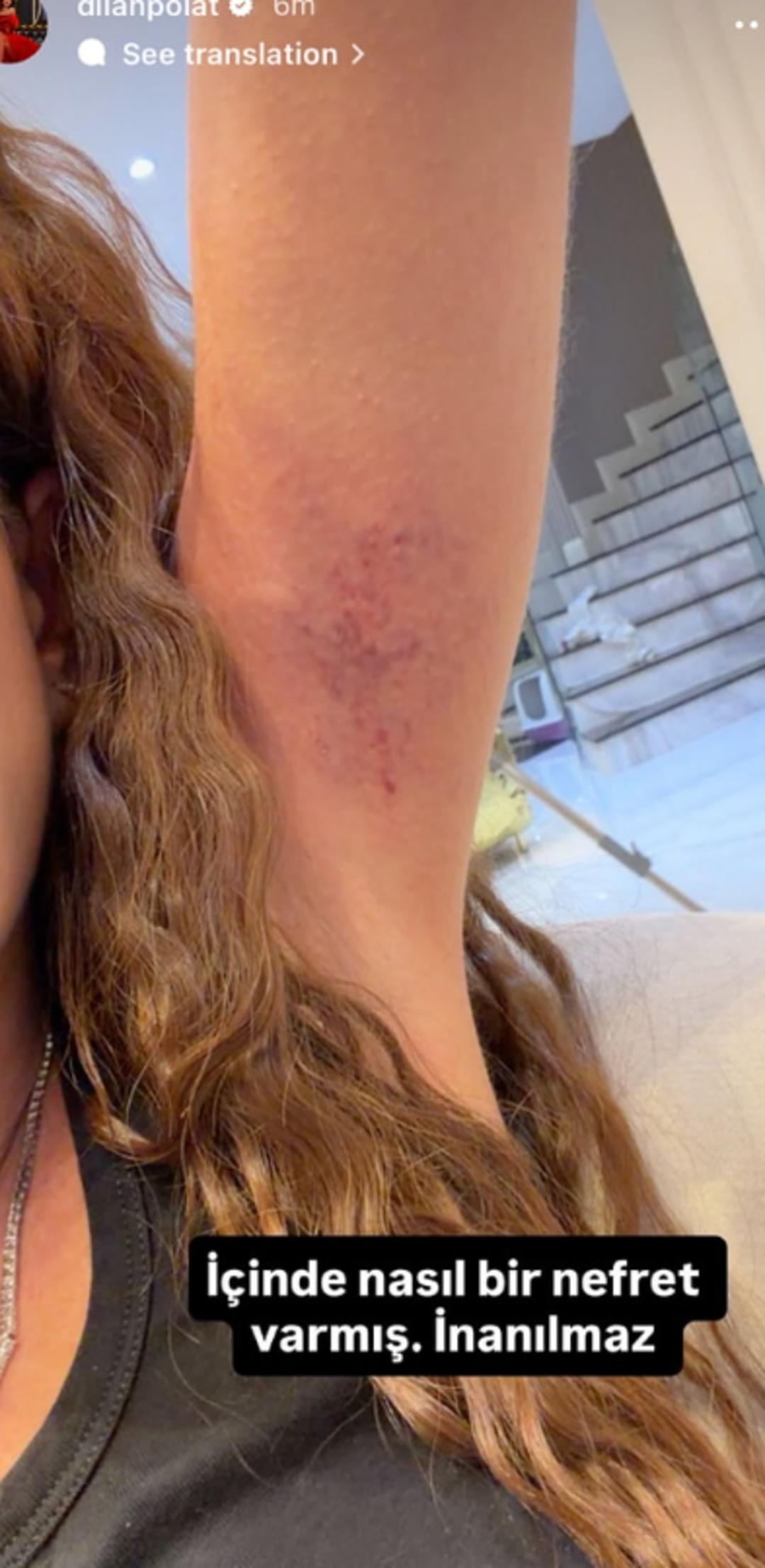 Sıla Doğu Dilan Polat ı d&ouml;vd&uuml;! Sa&ccedil;larını kopardı, kollarını morarttı 2