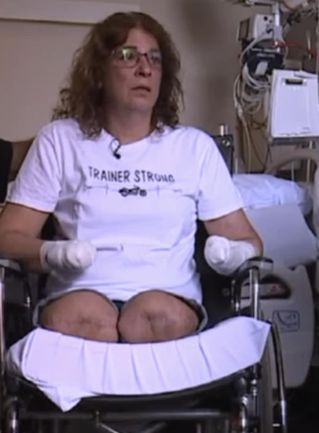 K&ouml;peği kolunu yaladı, hayatı karardı! Ger&ccedil;ek sonradan ortaya &ccedil;ıktı 2