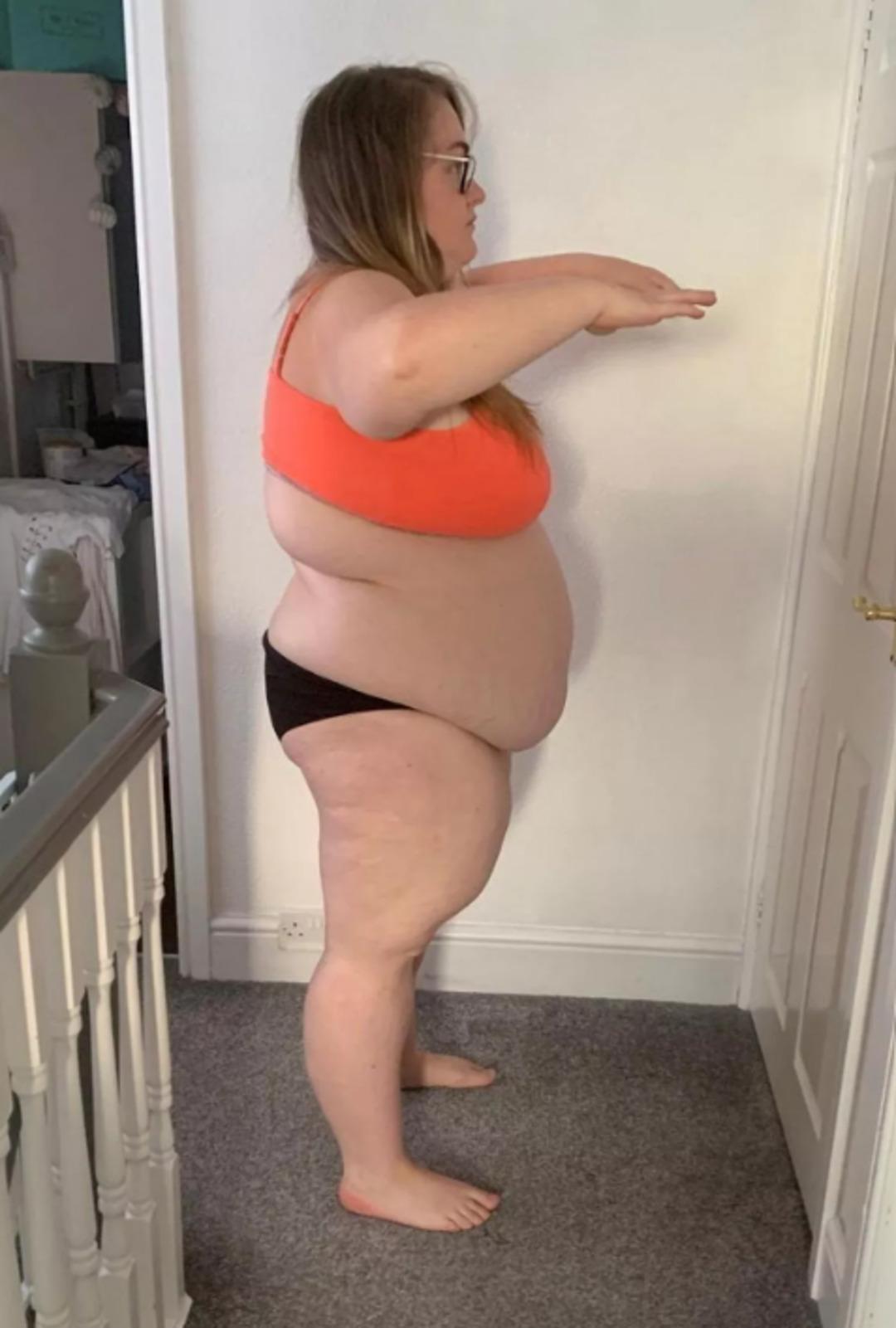 82 kilo verdi ama bedelini sağlığıyla &ouml;dedi: Beslenme listesinin &ouml;ncesi sonrası pes dedirtti 2