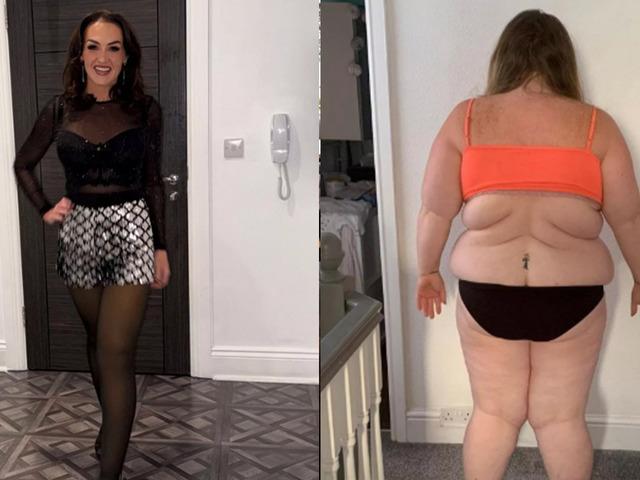 82 kilo verdi ama bedelini sağlığıyla &ouml;dedi