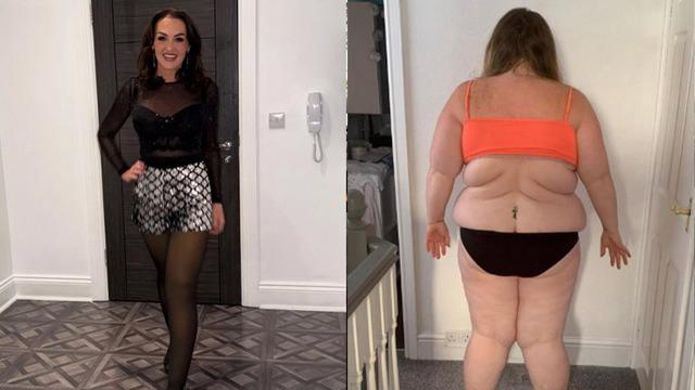 82 kilo verdi ama bedelini sağlığıyla ödedi: Beslenme listesinin öncesi sonrası pes dedirtti