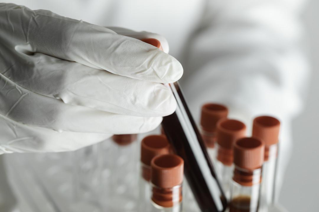 Kasım Garipoğlu ndan alicengiz oyunları: Kan değiştirmeye ta Miami ye gitmiş! 4