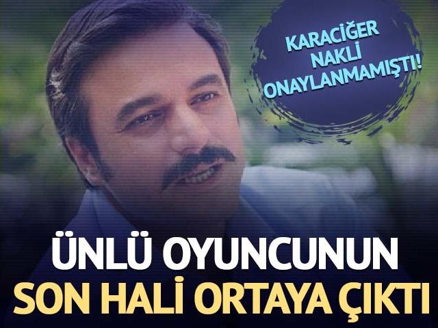 Karaciğer nakli onaylanmamıştı! Son hali ortaya &ccedil;ıktı
