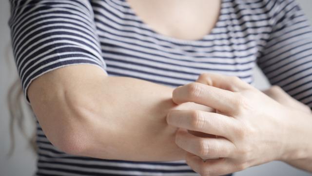 Kaşınan bir yeri kaşımak neden bu kadar rahatlatıcı gelir?