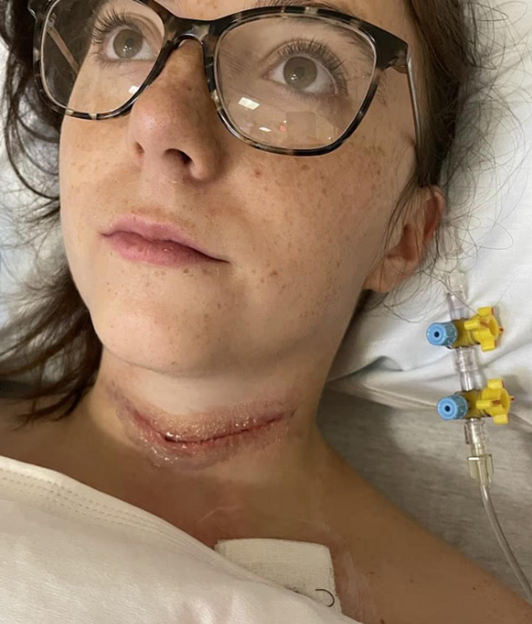 Yorgunluk ve halsizliği yoğun iş temposu sandı: Ger&ccedil;ek bambaşka &ccedil;ıktı! Boynu şişmeye başlayınca... 1