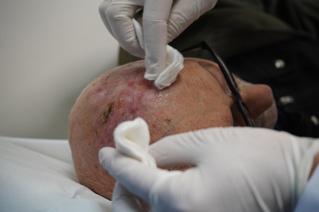 D&uuml;nyada iki &ouml;rneği vardı, &uuml;&ccedil;&uuml;nc&uuml;s&uuml; T&uuml;rkiye&rsquo;de ortaya &ccedil;ıktı 4