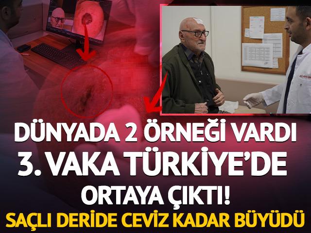 D&uuml;nyada sadece 3&rsquo;&uuml;nc&uuml; kez g&ouml;r&uuml;ld&uuml;!