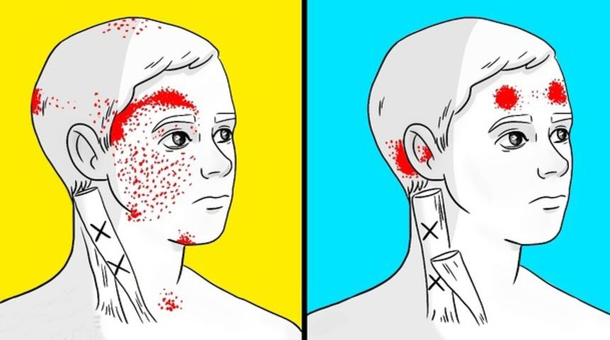 Baş ağrısı ve migreni tetikleyen besinler