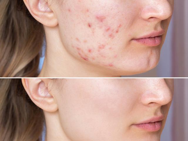 3 adımda g&uuml;zelleşmek i&ccedil;in y&ouml;ntemler