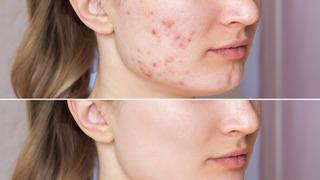 Cildinizi 3 adımda güzelleştirmenin yöntemleri!