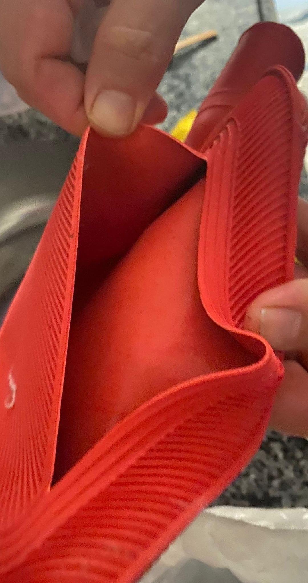 Gen&ccedil; kızın karnında sıcak su torbası patladı: "O acının tarifi yok" 1