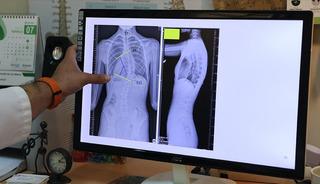 Sinsi ilerleyen rahatsızlık: İlk fark eden anneler oluyor!