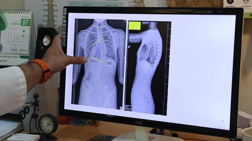 Sinsi ilerleyen rahatsızlık: İlk fark eden anneler oluyor!