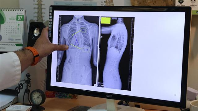 Sinsi ilerleyen rahatsızlık: İlk fark eden anneler oluyor!