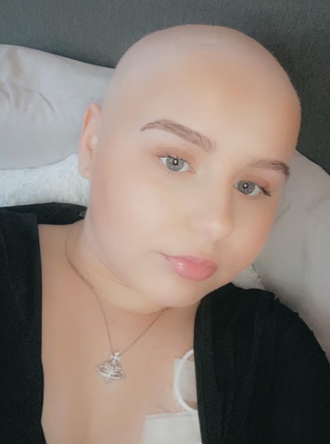 Kas ağrısı sanırken kemik kanseri &ccedil;ıktı! 16 yaşındaki kız omzundan 10 santimlik t&uuml;m&ouml;r taşıyormuş 1