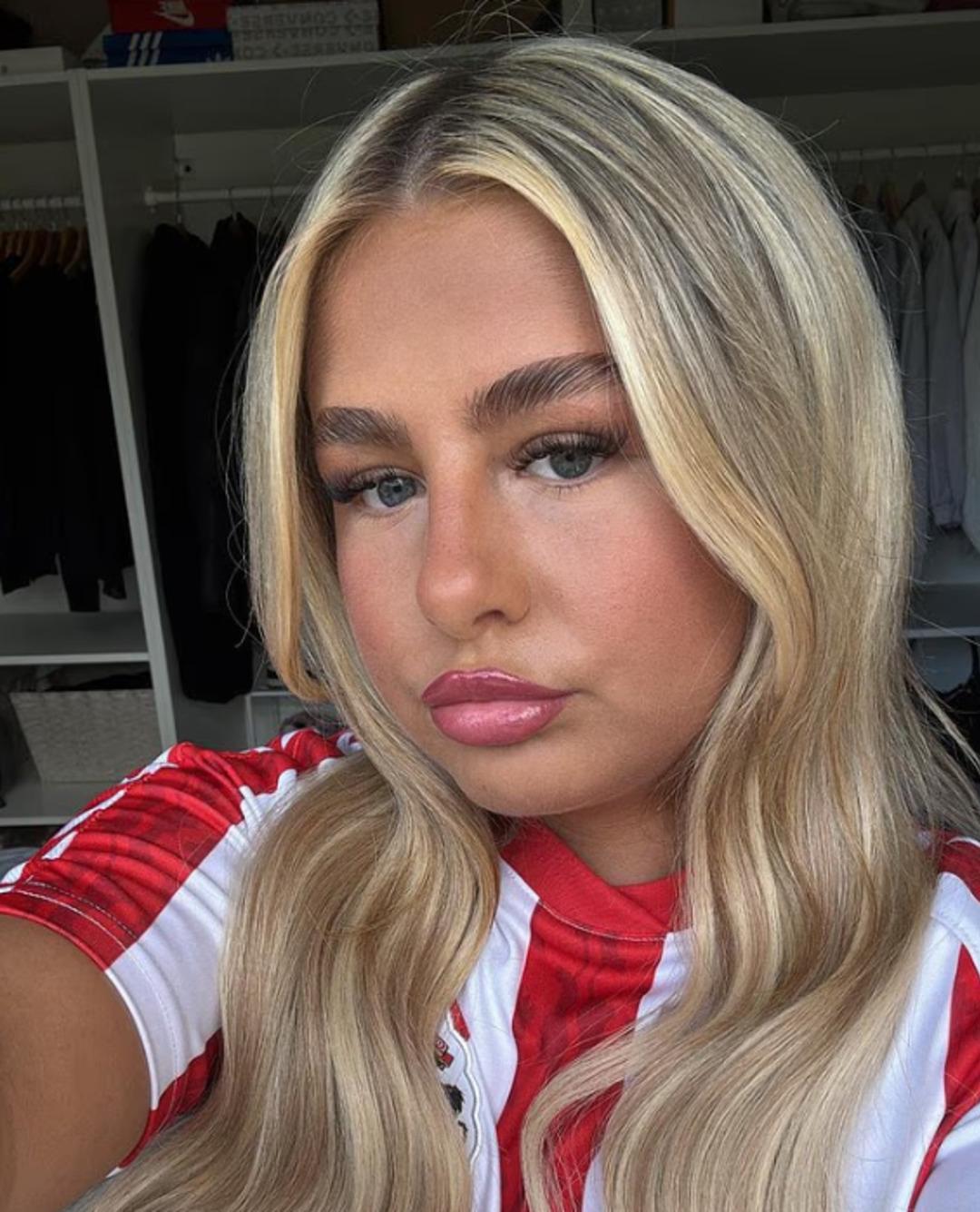 Kas ağrısı sanırken kemik kanseri &ccedil;ıktı! 16 yaşındaki kız omzundan 10 santimlik t&uuml;m&ouml;r taşıyormuş 3