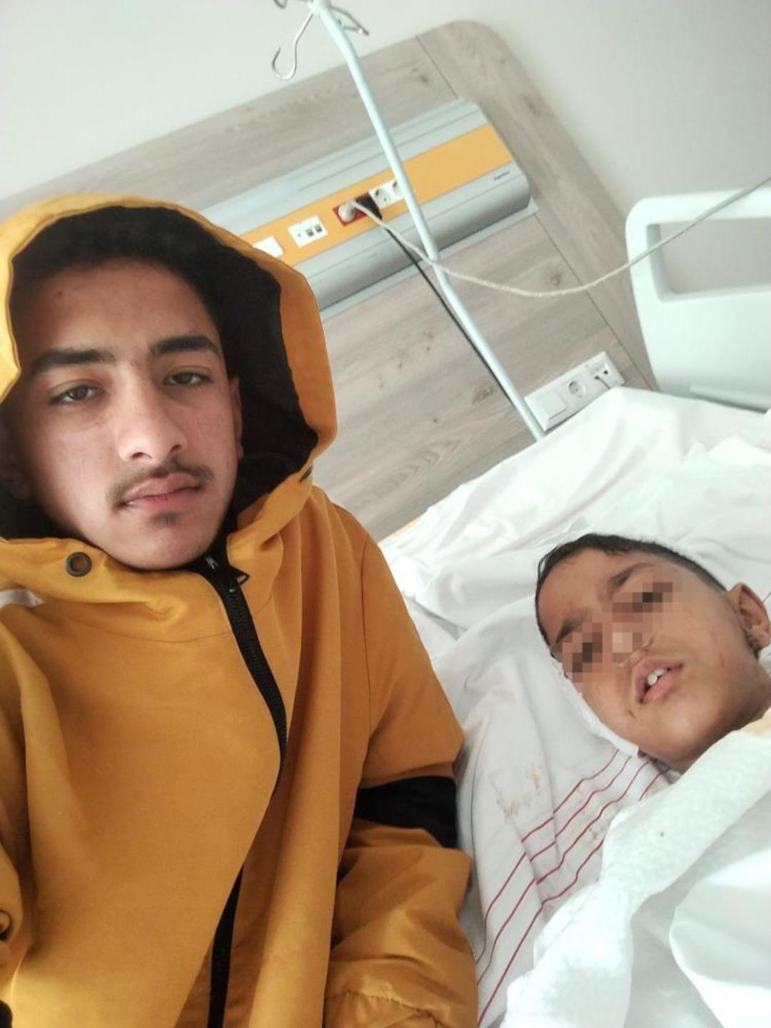 Yer: Ankara... Dehşeti yaşadı: Sokak k&ouml;peği saldırısı k&uuml;&ccedil;&uuml;k &ccedil;ocuğu canından ediyordu 1