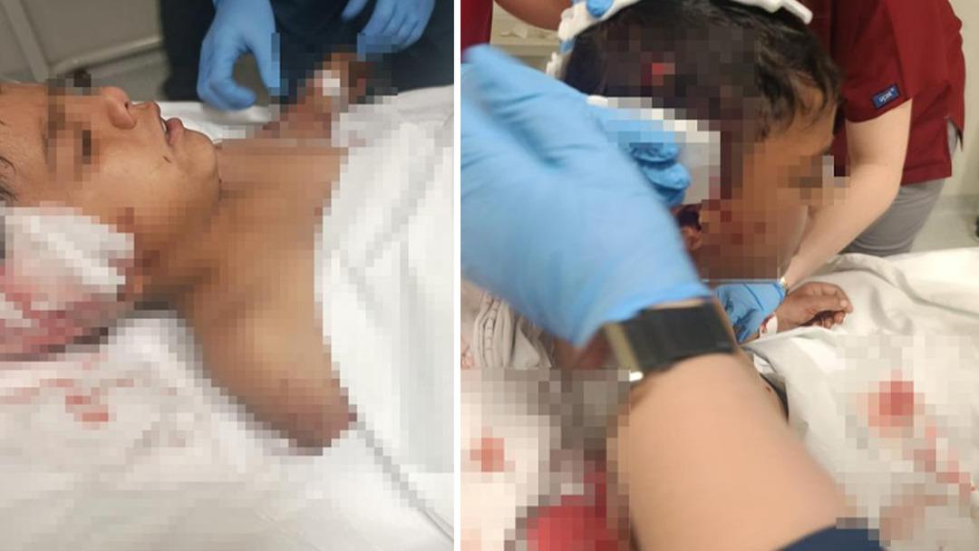 Yer: Ankara... Dehşeti yaşadı: Sokak k&ouml;peği saldırısı k&uuml;&ccedil;&uuml;k &ccedil;ocuğu canından ediyordu 2