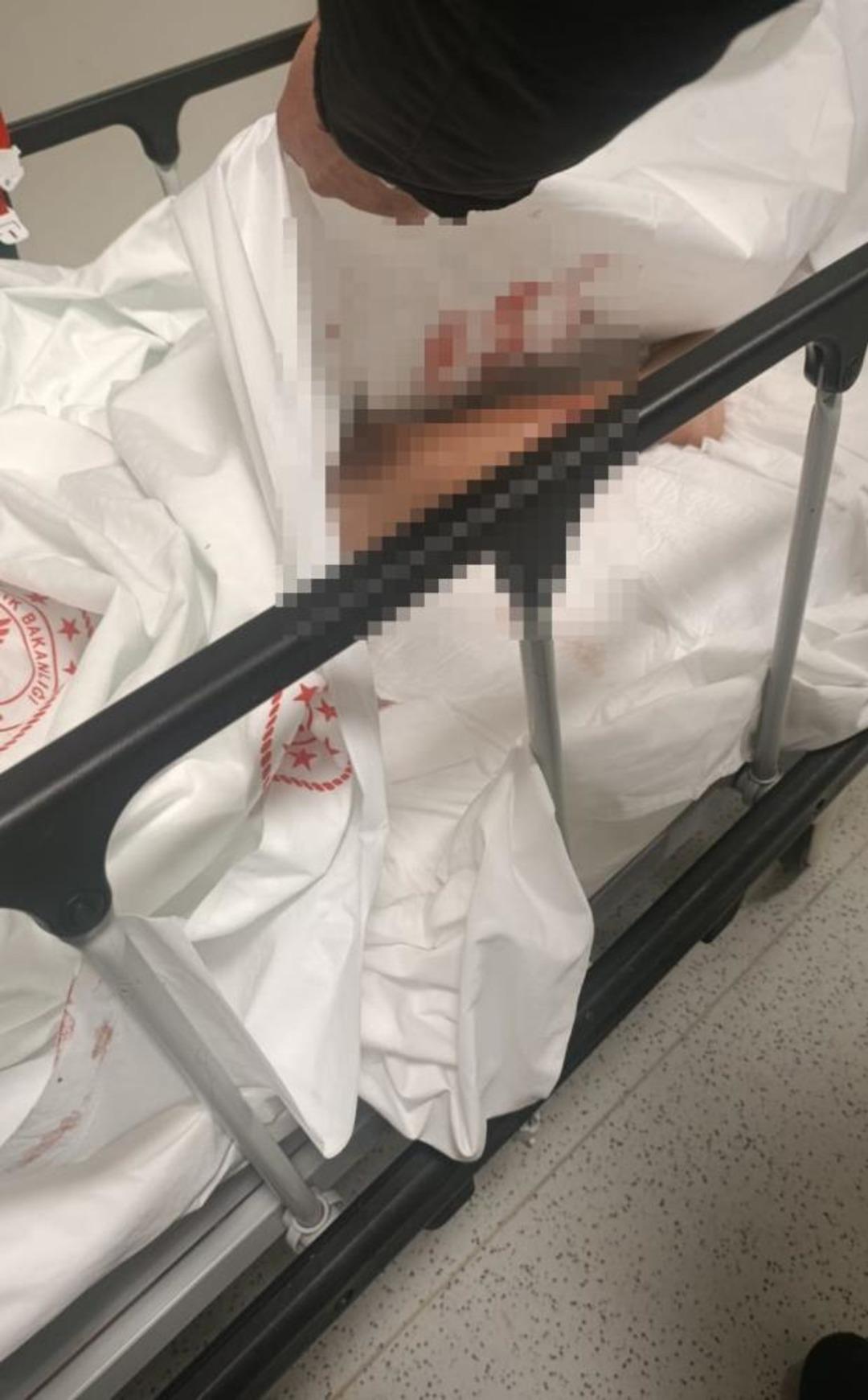 Yer: Ankara... Dehşeti yaşadı: Sokak k&ouml;peği saldırısı k&uuml;&ccedil;&uuml;k &ccedil;ocuğu canından ediyordu 3